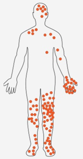 EPI protection anti coupure tronçonneuse